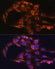 Cell Biology Antibodies 12 Anti-FCGRT Antibody CAB8544