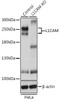 KO Validated Antibodies 1 Anti-L1CAM Antibody CAB8555KO Validated