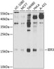 Cell Biology Antibodies 12 Anti-IER3 Antibody CAB8566