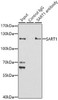 Epigenetics and Nuclear Signaling Antibodies 4 Anti-SART1 Antibody CAB8569