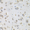 Cell Biology Antibodies 12 Anti-GNE Antibody CAB8570