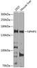 Metabolism Antibodies 3 Anti-Nephrocystin-3 Antibody CAB8580