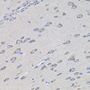 Cell Biology Antibodies 12 Anti-TMC1 Antibody CAB8595