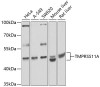 Cell Cycle Antibodies 2 Anti-TMPRSS11A Antibody CAB8605