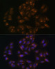 Cell Biology Antibodies 12 Anti-Sorting nexin-1 Antibody CAB8625