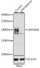 KO Validated Antibodies 1 Anti-ZMYND8 Antibody CAB8737KO Validated