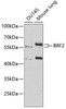 Metabolism Antibodies 3 Anti-BRF2 Antibody CAB8782