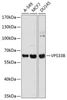 Cell Biology Antibodies 12 Anti-VPS33B Antibody CAB8799