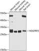 Cell Biology Antibodies 12 Anti-HDGFRP3 Antibody CAB8815