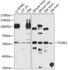 Epigenetics and Nuclear Signaling Antibodies 4 Anti-SS18L1 Antibody CAB8822