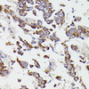 Metabolism Antibodies 3 Anti-SUCLG2 Antibody CAB8976