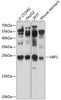 Cell Biology Antibodies 12 Anti-Prefoldin subunit 3 Antibody CAB8990