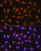 Immunology Antibodies 3 Anti-RPSA Antibody CAB9008