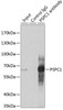 Cell Biology Antibodies 12 Anti-PSPC1 Antibody CAB9209