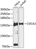 Cell Cycle Antibodies 2 Anti-CDCA2 Antibody CAB9291