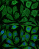 Cell Biology Antibodies 12 Anti-SARDH Antibody CAB9541