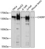 Cell Biology Antibodies 12 Anti-CHERP Antibody CAB9702