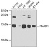 Cell Death Antibodies 2 Anti-PMAIP1 Antibody CAB9801