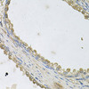 Cell Biology Antibodies 12 Anti-MTERFD1 Antibody CAB9804