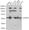 Cell Biology Antibodies 12 Anti-MTERFD1 Antibody CAB9804