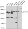 Cell Biology Antibodies 12 Anti-EPS15 Antibody CAB9814