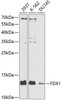 Metabolism Antibodies 3 Anti-FDX1 Antibody CAB9815