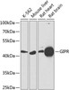 Cell Biology Antibodies 12 Anti-GIPR Antibody CAB9816