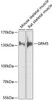 Cell Biology Antibodies 12 Anti-GRM5 Antibody CAB9819