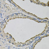 Signal Transduction Antibodies 3 Anti-Lipocalin-1 Antibody CAB9828