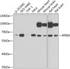 Signal Transduction Antibodies 3 Anti-RPE65 Antibody CAB9841