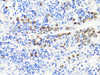 Cell Death Antibodies 2 Anti-Protein S100-A9 Antibody CAB9842