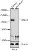 KO Validated Antibodies 1 Anti-BAZ1B Antibody CAB9851KO Validated