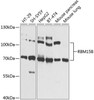 Immunology Antibodies 3 Anti-RBM15B Antibody CAB9873