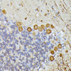 Neuroscience Anti-ELP3 Antibody CAB9877