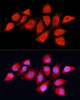 Metabolism Antibodies 3 Anti-PDHA2 Antibody CAB9943