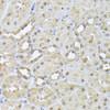 Immunology Antibodies 3 Anti-PSMB3 Antibody CAB9947