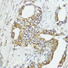 Developmental Biology Anti-SOCS6 Antibody CAB9957