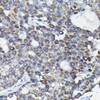 Cell Cycle Antibodies 2 Anti-RGS14 Antibody CAB9962