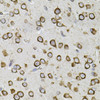 Cell Cycle Antibodies 2 Anti-CEP164 Antibody CAB9964