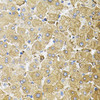 Cell Cycle Antibodies 2 Anti-CEP164 Antibody CAB9964