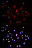 Cell Cycle Antibodies 2 Anti-Phospho-ATM-S1981 Antibody CABP0008