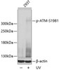 Cell Cycle Antibodies 2 Anti-Phospho-ATM-S1981 Antibody CABP0008