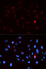 Cell Death Antibodies 2 Anti-Phospho-CDK1-T14 Antibody CABP0015