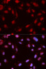 Cell Cycle Antibodies 2 Anti-Phospho-CHEK1-S280 Antibody CABP0017