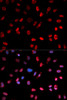 Epigenetics and Nuclear Signaling Antibodies 4 Anti-Phospho-ATF2-T71 Antibody CABP0020