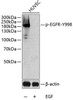 Immunology Antibodies 3 Anti-Phospho-EGFR-Y998 Antibody CABP0024