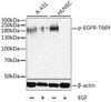 Immunology Antibodies 3 Anti-Phospho-EGFR-T669 Antibody CABP0025