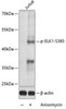 Epigenetics and Nuclear Signaling Antibodies 4 Anti-Phospho-ELK1-S383 Antibody CABP0033