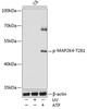 Cell Death Antibodies 2 Anti-Phospho-MAP2K4-T261 Antibody CABP0069