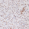 Immunology Antibodies 3 Anti-Phospho-Stat3-Y705 Antibody CABP0070